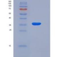 大鼠白介素18受体1(IL18R1)重组蛋白His tag