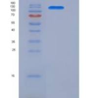 人JAG1 / Jagged 1 / CD339重组蛋白Fc tag