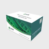 外泌体蛋白提取试剂盒（20T| Micro-Exosome-Protein-Extraction-Kit