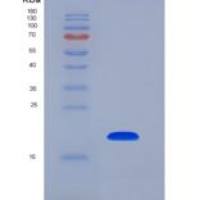 人LCN1 / VEGP / Lipocalin-1重组蛋白His tag