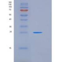 人ASAM重组蛋白His Tag