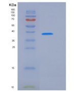 大鼠ALK-2 / ACVR1 / ALK2 重组蛋白Fc 