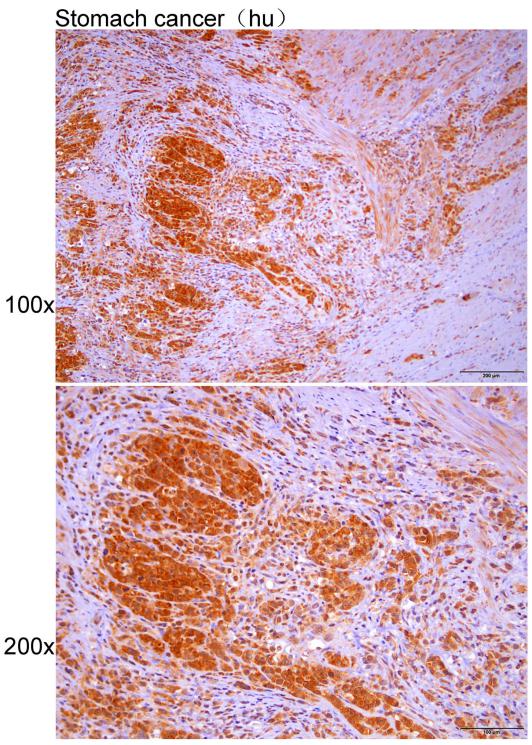 Anti-AFF2 Polyclonal Antibody