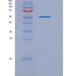 人P4HB重组蛋白His Tag