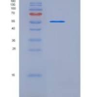 人P4HB重组蛋白His Tag