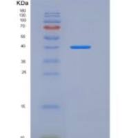 人FGFR2 / CD332重组蛋白His tag