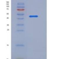 人CD27 / TNFRSF7重组蛋白His & Fc tag