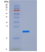 人CD27 / TNFRSF7重组蛋白His tag