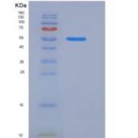 大鼠KIRREL3 / NEPH2重组蛋白His tag