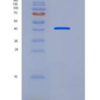 小鼠Chitinase-like 3 / Chi3l3重组蛋白His tag