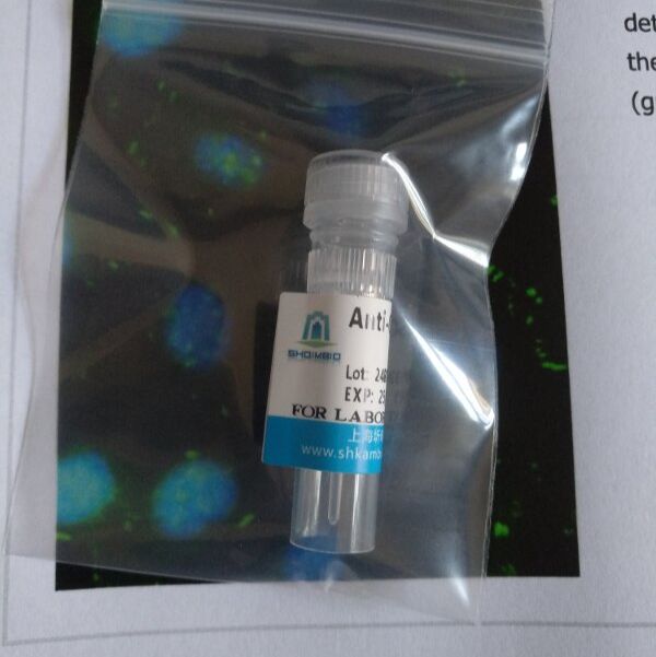 兔抗人MSRB3多克隆抗体(ELISA,IHC,WB)