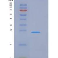 人FcERI / FCER1A重组蛋白His tag