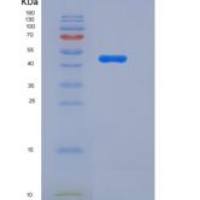 人PROC1 / Protein C / PROC重组蛋白His tag