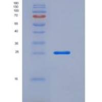 人内皮细胞粘附分子(ESAM)重组蛋白