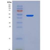 人内皮细胞粘附分子(ESAM)重组蛋白Fc tag