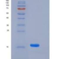 人FABP4 / ALBP / A-FABP重组蛋白29 Ala/Thr, His tag