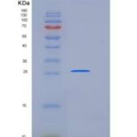 小鼠MBL-2 / MBL重组蛋白His Tag