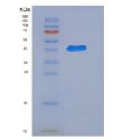 人半乳糖凝集素-7/LGALS7重组蛋白GST tag