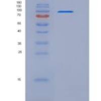 人CD21 / CR2 / C3DR重组蛋白His tag