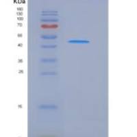 人ST6GAL1重组蛋白His Tag