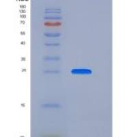 人GLIPR1重组蛋白His Tag