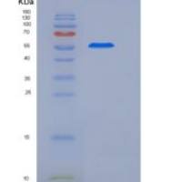 大鼠IL17RA / IL17R重组蛋白Fc tag