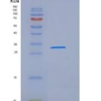 大鼠IL2RG / CD132重组蛋白His tag