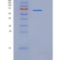 小鼠GAD65 / GAD2重组蛋白