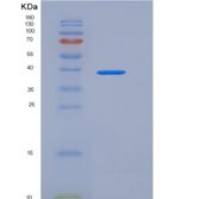人CD113 / Nectin-3 / PVRL3重组蛋白His tag