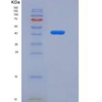 人FcRn & B2M异二聚体重组蛋白C-6His