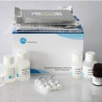 Rat mitochondrial dysfunction OXPHOS ELISA Kit|大鼠mitochondrial dysfunction OXPHOS ELISA试剂盒