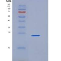 人类粘蛋白2(ORM2)重组蛋白His tag