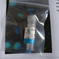 兔抗SNAP23多克隆抗体(WB,IHC,ELISA)