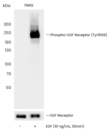 蛋白磷酸化研究和选对抗体究竟是什么关系？