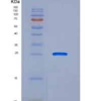 人免疫球蛋白α Fc受体/FCAR/CD89重组蛋白C-6His