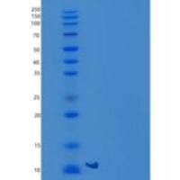 人S100钙结合蛋白B(S100B)重组蛋白His Tag