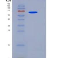 人CD155 / PVR / NECL5重组蛋白Fc tag