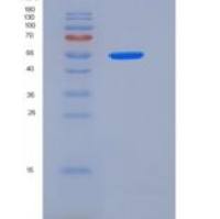 大鼠GPT1 / GPT重组蛋白His tag