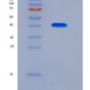 人CD247 / CD3-ZETA重组蛋白GST tag