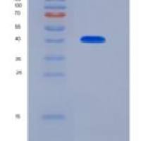 人CD247 / CD3-ZETA重组蛋白GST tag