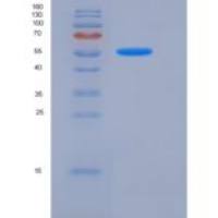 大鼠ALCAM / CD166重组蛋白His tag