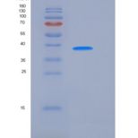 大鼠ALK-2 / ACVR1 / ALK2 重组蛋白Fc tag