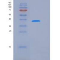 大鼠ALK-2 / ACVR1 / ALK2 重组蛋白Fc tag