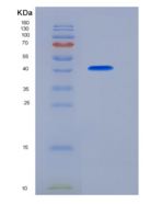 人FCGRT & B2M Heterodimer重组蛋白