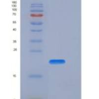 人CD27 / TNFRSF7重组蛋白His tag