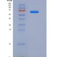 人成纤维细胞生长因子受体2(FGFR2)重组蛋白His & Fc tag