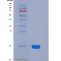 小鼠FABP4 / ALBP / A-FABP重组蛋白His tag