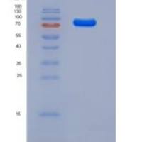 人VEGFR3 / FLT4重组蛋白His tag