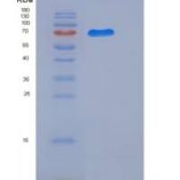 人热休克蛋白70 / HSPA1A重组蛋白His tag