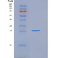 小鼠CD86 / B7-2重组蛋白His tag
